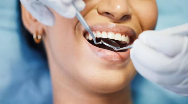 Best Cracked Tooth Emergency Dentist  in Belton, MO